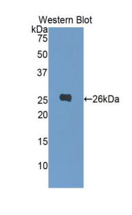 PCSK9 Antibody - Western blot of recombinant PCSK9.  This image was taken for the unconjugated form of this product. Other forms have not been tested.