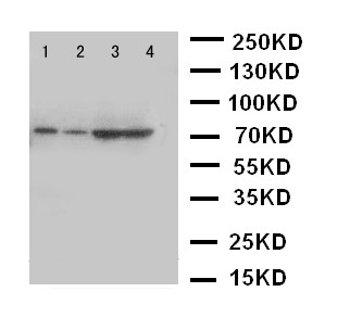 PCSK9 Antibody - WB of PCSK9 antibody. Lane 1: A549 Cell Lysate. Lane 2: HELA Cell Lysate. Lane 3: U87 Cell Lysate. Lane 4: PANC Cell Lysate.