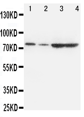 PCSK9 Antibody - Anti-PCSK9 antibody, Western blotting All lanes: Anti PCSK9 at 0.5ug/ml Lane 1: A549 Whole Cell Lysate at 40ug Lane 2: HELA Whole Cell Lysate at 40ug Lane 3: U87 Whole Cell Lysate at 40ug Lane 4: PANC Whole Cell Lysate at 40ug Predicted bind size: 74KD Observed bind size: 74KD