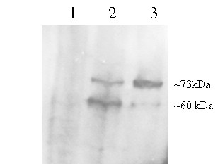 PCSK9 Antibody - Antibody staining (0.2 ug/ml) of McA cell lysates: untransfected (1), transfected with wild type human pcsk9 (2), transfected with S127R human pcsk9 (3).
