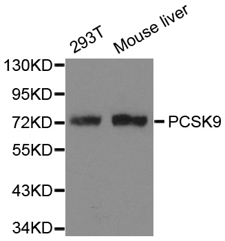 PCSK9 Antibody - Western blot analysis of extracts of HepG2 cell line, using PCSK9 antibody.