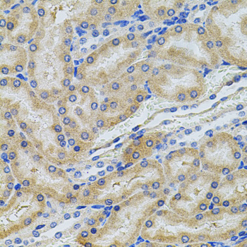 PCSK9 Antibody - Immunohistochemistry of paraffin-embedded rat kidney tissue.