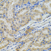 PCSK9 Antibody - Immunohistochemistry of paraffin-embedded rat kidney tissue.