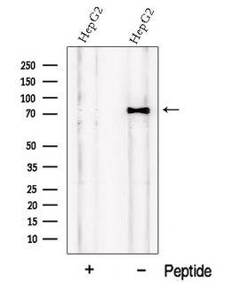 PCSK9 Antibody - Western blot analysis of extracts of HepG2 cells using PCSK9 antibody. The lane on the left was treated with blocking peptide.
