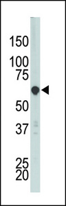 PCTK3 / CDK18 Antibody - The anti-PCTK3 antibody is used in Western blot to detect PCTK3 in HL-60 cell lysate.