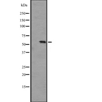 PCTK3 / CDK18 Antibody - Western blot analysis of PCTK3 expression in A431 whole cells lysate. The lane on the left is treated with the antigen-specific peptide.