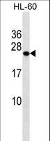 PCTP Antibody - PCTP Antibody western blot of HL-60 cell line lysates (35 ug/lane). The PCTP antibody detected the PCTP protein (arrow).