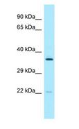 PCTP Antibody - PCTP antibody Western Blot of 721_B.  This image was taken for the unconjugated form of this product. Other forms have not been tested.