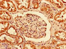 PCTP Antibody - Immunohistochemistry of paraffin-embedded human kidney tissue using PCTP Antibody at dilution of 1:100