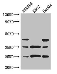 PCTP Antibody - Western Blot Positive WB detected in: HEK293 whole cell lysate, K562 whole cell lysate, HepG2 whole cell lysate All lanes: PCTP antibody at 3µg/ml Secondary Goat polyclonal to rabbit IgG at 1/50000 dilution Predicted band size: 25, 17 kDa Observed band size: 25, 35, 45 kDa