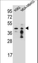 PCYT1A / CCT Alpha Antibody - PCYT1A Antibody western blot of K562,MDA-MB453 cell line lysates (35 ug/lane). The PCYT1A antibody detected the PCYT1A protein (arrow).