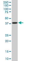 PCYT1A / CCT Alpha Antibody - PCYT1A monoclonal antibody (M02), clone 6E6. Western blot of PCYT1A expression in PC-12.