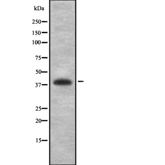 PCYT1A / CCT Alpha Antibody - Western blot analysis of PCYT1A using K562 whole lysates.