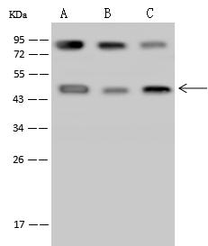 PCYT1A / CCT Alpha Antibody - Anti-PCYT1A rabbit polyclonal antibody at 1:500 dilution. Lane A: HepG2 Whole Cell Lysate. Lane B: Hela Whole Cell Lysate. Lane C: A549 Whole Cell Lysate. Lysates/proteins at 30 ug per lane. Secondary: Goat Anti-Rabbit IgG (H+L)/HRP at 1/10000 dilution. Developed using the ECL technique. Performed under reducing conditions. Predicted band size: 42 kDa. Observed band size: 45 kDa.