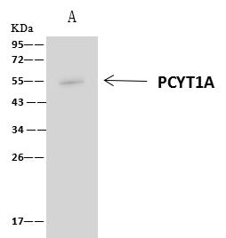 PCYT1A / CCT Alpha Antibody - PCYT1A was immunoprecipitated using: Lane A: 0.5 mg HepG2 Whole Cell Lysate. 4 uL anti-PCYT1A rabbit polyclonal antibody and 60 ug of Immunomagnetic beads Protein A/G. Primary antibody: Anti-PCYT1A rabbit polyclonal antibody, at 1:100 dilution. Secondary antibody: Clean-Blot IP Detection Reagent (HRP) at 1:1000 dilution. Developed using the ECL technique. Performed under reducing conditions. Predicted band size: 42 kDa. Observed band size: 50 kDa.