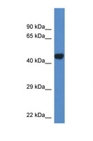 PCYT2 / ET Antibody - PCYT2 antibody Western blot of Mouse Heart lysate. Antibody concentration 1 ug/ml. This image was taken for the unconjugated form of this product. Other forms have not been tested.