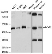 PCYT2 / ET Antibody - Western blot analysis of extracts of various cell lines, using PCYT2 antibody at 1:1000 dilution. The secondary antibody used was an HRP Goat Anti-Rabbit IgG (H+L) at 1:10000 dilution. Lysates were loaded 25ug per lane and 3% nonfat dry milk in TBST was used for blocking. An ECL Kit was used for detection and the exposure time was 1s.