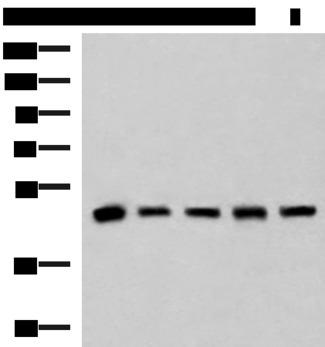 PCYT2 / ET Antibody - Western blot analysis of Human fetal liver tissue HepG2 A172 Hela and Jurkat cell lysates  using PCYT2 Polyclonal Antibody at dilution of 1:800