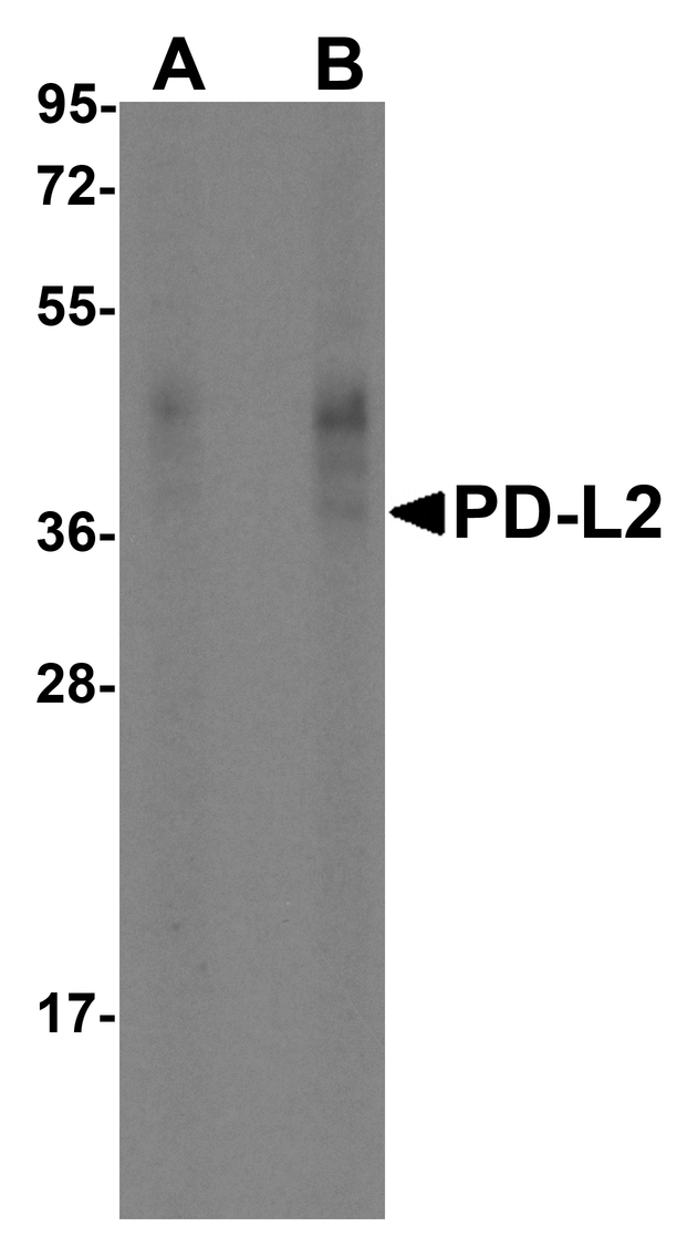 PD-L2 / PDCD1LG2 / CD273 Antibody - Western blot analysis of PD-L2 in overexpressing HEK293 cells PD-L2 antibody at 0.5 and 1 ug/ml