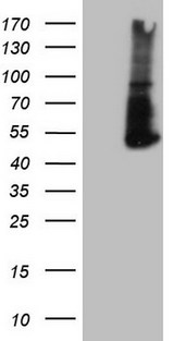 PD-L2 / PDCD1LG2 / CD273 Antibody - HEK293T cells were transfected with the pCMV6-ENTRY control. (Left lane) or pCMV6-ENTRY PDCD1LG2. (Right lane) cDNA for 48 hrs and lysed. Equivalent amounts of cell lysates. (5 ug per lane) were separated by SDS-PAGE and immunoblotted with anti-PDCD1LG2. (1:2000)