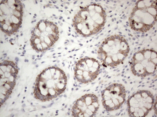 PD-L2 / PDCD1LG2 / CD273 Antibody - Immunohistochemical staining of paraffin-embedded Human colon tissue within the normal limits using anti-PDCD1LG2 mouse monoclonal antibody. (Heat-induced epitope retrieval by 1mM EDTA in 10mM Tris buffer. (pH8.5) at 120°C for 3 min. (1:150)