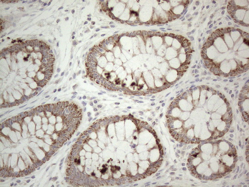 PD-L2 / PDCD1LG2 / CD273 Antibody - Immunohistochemical staining of paraffin-embedded Human colon tissue within the normal limits using anti-PDCD1LG2 mouse monoclonal antibody. (Heat-induced epitope retrieval by 1mM EDTA in 10mM Tris buffer. (pH8.5) at 120°C for 3 min. (1:150).