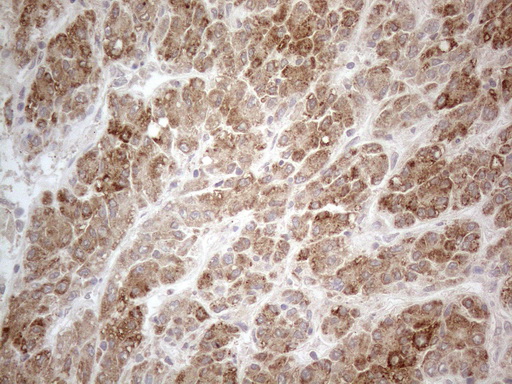 PD-L2 / PDCD1LG2 / CD273 Antibody - Immunohistochemical staining of paraffin-embedded Human liver tissue within the normal limits using anti-PDCD1LG2 mouse monoclonal antibody. (Heat-induced epitope retrieval by 1mM EDTA in 10mM Tris buffer. (pH8.5) at 120°C for 3 min. (1:150).