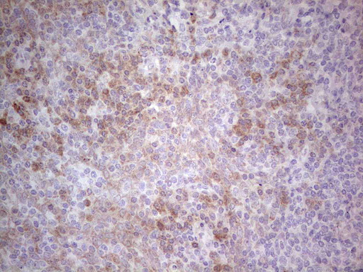 PD-L2 / PDCD1LG2 / CD273 Antibody - Immunohistochemical staining of paraffin-embedded Human tonsil within the normal limits using anti-PDCD1LG2 mouse monoclonal antibody. (Heat-induced epitope retrieval by 1 mM EDTA in 10mM Tris, pH8.5, 120C for 3min,