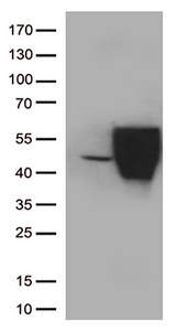 PD-L2 / PDCD1LG2 / CD273 Antibody - HEK293T cells were transfected with the pCMV6-ENTRY control. (Left lane) or pCMV6-ENTRY PDL2. (Right lane) cDNA for 48 hrs and lysed. Equivalent amounts of cell lysates. (5 ug per lane) were separated by SDS-PAGE and immunoblotted with anti-PDL2(1:1k)