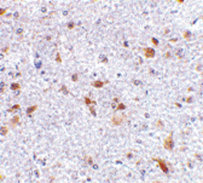 PD-L2 / PDCD1LG2 / CD273 Antibody - Immunohistochemistry of PDL-2 in mouse brain tissue with PDL-2 antibody at 2.5 ug/ml.
