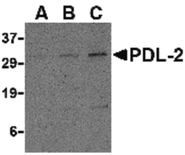 PD-L2 / PDCD1LG2 / CD273 Antibody - Western blot of PDL-2 in Raji cell lysate with PDL-2 antibody at (A) 0.5, (B) 1 and (C) 2 ug/ml.