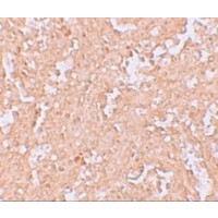 PD-L2 / PDCD1LG2 / CD273 Antibody - Immunohistochemistry of ZBTB8 in human spleen tissue with ZBTB9 antibody at 2.5 µg/mL.