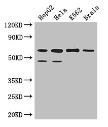 PD2 / PAF1 Antibody - Western Blot Positive WB detected in: HepG2 whole cell lysate, Hela whole cell lysate, K562 whole cell lysate, Mouse brain tissue All lanes: PAF1 antibody at 3.2µg/ml Secondary Goat polyclonal to rabbit IgG at 1/50000 dilution Predicted band size: 60, 56 kDa Observed band size: 60, 48 kDa