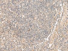 PD2 / PAF1 Antibody - Immunohistochemistry of paraffin-embedded Human tonsil tissue  using PAF1 Polyclonal Antibody at dilution of 1:45(×200)