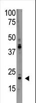 PDAP1 Antibody - The anti-PDAP1 Antibody is used in Western blot to detect PDAP1 in HL60 lysate.