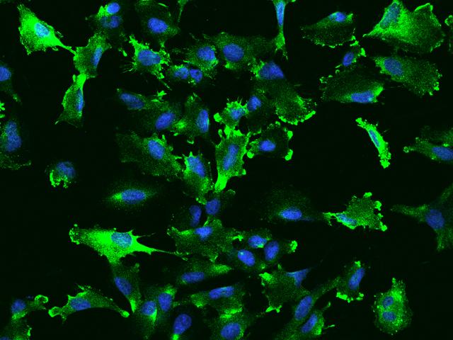 PDAP1 Antibody - Immunofluorescence staining of PDAP1 in U251MG cells. Cells were fixed with 4% PFA, blocked with 10% serum, and incubated with rabbit anti-Human PDAP1 polyclonal antibody (dilution ratio 1:200) at 4°C overnight. Then cells were stained with the Alexa Fluor 488-conjugated Goat Anti-rabbit IgG secondary antibody (green) and counterstained with DAPI (blue). Positive staining was localized to Cytoplasm and cell membrane.