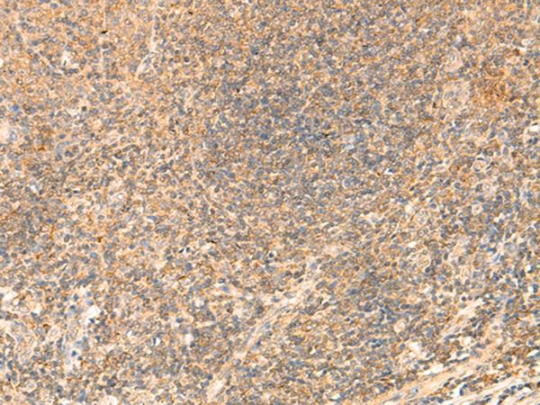 PDAP1 Antibody - Immunohistochemistry of paraffin-embedded Human tonsil tissue  using PDAP1 Polyclonal Antibody at dilution of 1:50(×200)