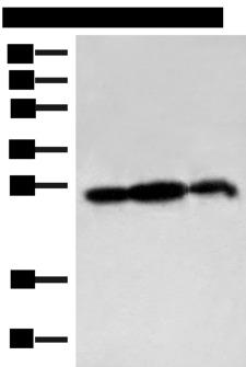 PDAP1 Antibody - Western blot analysis of 293T cell and Rat brain tissue lysates  using PDAP1 Polyclonal Antibody at dilution of 1:400