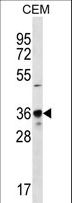 PDC Antibody - PDC Antibody western blot of CEM cell line lysates (35 ug/lane). The PDC antibody detected the PDC protein (arrow).