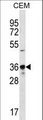 PDC Antibody - PDC Antibody western blot of CEM cell line lysates (35 ug/lane). The PDC antibody detected the PDC protein (arrow).