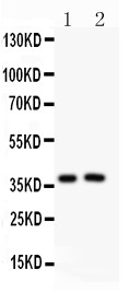 PDCD1 / CD279 / PD-1 Antibody - PD1 antibody , . All lanes: Anti PD1 at 0.5 ug/ml. Lane 1: JURKAT Whole Cell Lysate at 40 ug. Lane 2: Human Placenta Tissue Lysate at 50 ug. Predicted band size: 32 kD . Observed band size: 38 kD.