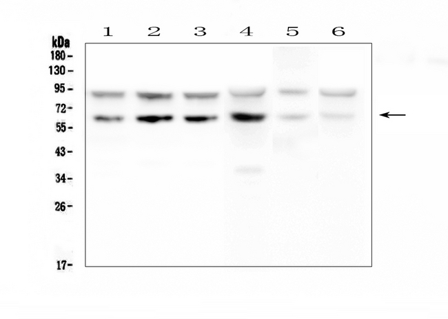 PDCD1 / CD279 / PD-1 Antibody - Western blot analysis of PD1/PDCD1 using anti-PD1/PDCD1 antibody. Electrophoresis was performed on a 5-20% SDS-PAGE gel at 70V (Stacking gel) / 90V (Resolving gel) for 2-3 hours. The sample well of each lane was loaded with 50ug of sample under reducing conditions. Lane 1: human Caco-2 whole cell lysates, Lane 2: human SW620 whole cell lysates, Lane 3: human COLO-320 whole cell lysates, Lane 4: human K562 whole cell lysates, Lane 5: mouse thymus tissue lysates, Lane 6: mouse RAW246. 7 whole cell lysates. After Electrophoresis, proteins were transferred to a Nitrocellulose membrane at 150mA for 50-90 minutes. Blocked the membrane with 5% Non-fat Milk/ TBS for 1.5 hour at RT. The membrane was incubated with rabbit anti-PD1/PDCD1 antigen affinity purified polyclonal antibody at 0.5 µg/mL overnight at 4°C, then washed with TBS-0.1% Tween 3 times with 5 minutes each and probed with a goat anti-rabbit IgG-HRP secondary antibody at a dilution of 1:10000 for 1.5 hour at RT. The signal is developed using an Enhanced Chemiluminescent detection (ECL) kit with Tanon 5200 system. A specific band was detected for PD1/PDCD1 at approximately 65KD. The expected band size for PD1/PDCD1 is at 32KD.