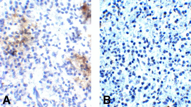 PDCD1 / CD279 / PD-1 Antibody - (A) Immunohistochemistry of PD-1 in human spleen tissue with PD-1 [10B3] antibody at 10 ug/mL. (B) Immunohistochemistry in human spleen tissue with control mouse IgG staining at 10 ug/mL.