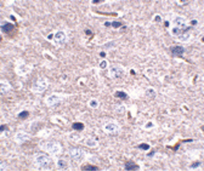 PDCD1 / CD279 / PD-1 Antibody - Immunohistochemistry of PD-1 in mouse brain tissue with PD-1 antibody at 2.5 ug/ml.