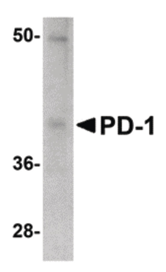 PDCD1 / CD279 / PD-1 Antibody - Western blot of PD-1 in A-20 cell lysate with PD-1 antibody at 1 ug/ml.