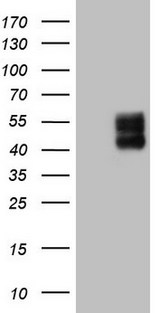 PDCD1 / CD279 / PD-1 Antibody - HEK293T cells were transfected with the pCMV6-ENTRY control. (Left lane) or pCMV6-ENTRY PDCD1. (Right lane) cDNA for 48 hrs and lysed. Equivalent amounts of cell lysates. (5 ug per lane) were separated by SDS-PAGE and immunoblotted with anti-PDCD1. (1:2000)