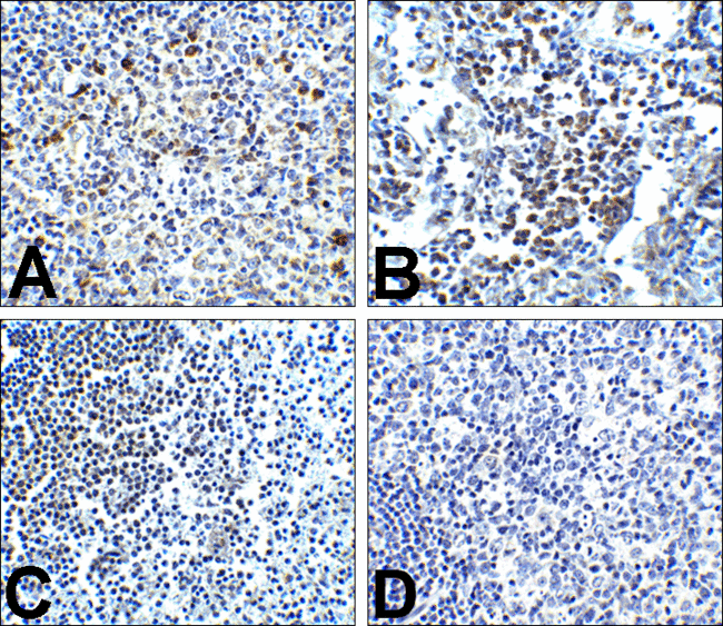 PDCD1 / CD279 / PD-1 Antibody - Immunohistochemistry of PD-1 in (A) human tonsil tissue, (B) human lymph node tissue, and (C) human spleen tissue with PD-1 antibody at 5 ug/mL. (D) Immunohistochemistry in human tonsil tissue with control mouse IgG staining at 5 ug/mL.