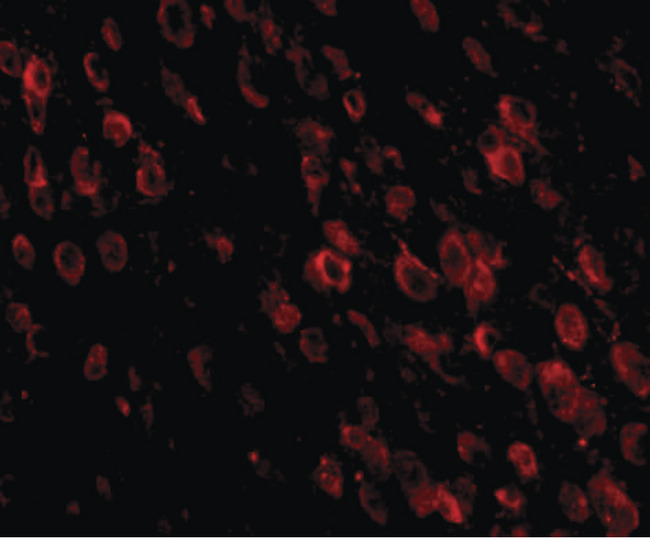 PDCD1 / CD279 / PD-1 Antibody - Immunofluorescence of PD-1 in mouse brain tissue with PD-1 antibody at 20 ug/ml.