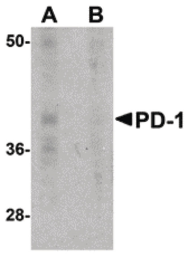 PDCD1 / CD279 / PD-1 Antibody - Western blot of PD-1 in A-20 cell lysate with PD-1 antibody at 1 ug/ml in the (A) absence and (B) presence of blocking recombinant protein.