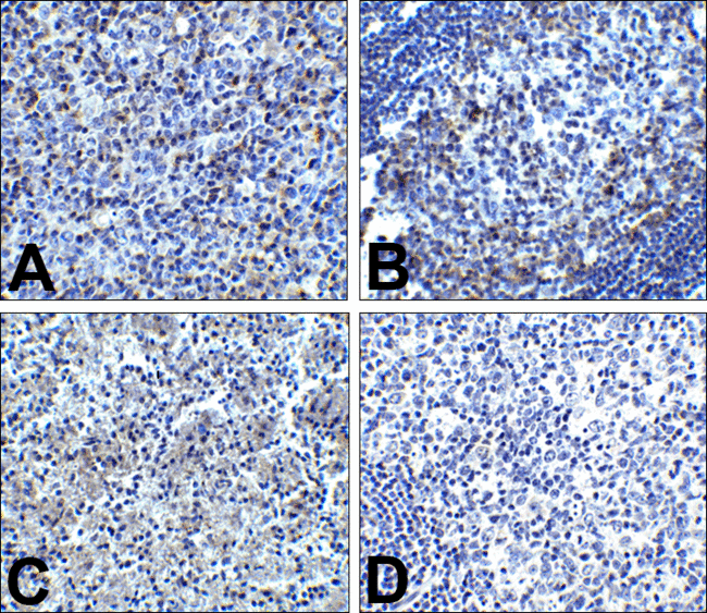 PDCD1 / CD279 / PD-1 Antibody - Immunohistochemistry of PD-1 in (A) human tonsil tissue, (B) human lymph node tissue, and (C) human spleen tissue with PD-1 antibody at 5 ug/mL. (D) Immunohistochemistry in human tonsil tissue with control mouse IgG staining at 5 ug/mL.